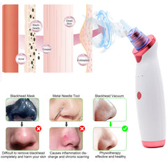 Blackhead Remover Pore Vacuum Cleaner Electric USB Pore Vacuum with 5