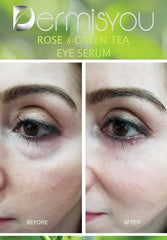 Anti-Wrinkle Eye Serum with Green Tea & Rose Water - Horizon Bliss