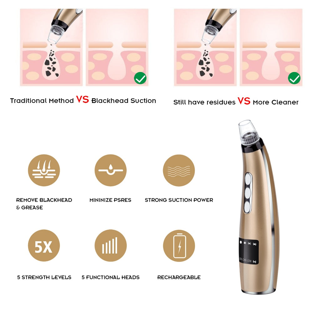 Blackhead Remover Face Clean Pore Vacuum Acne - Horizon Bliss