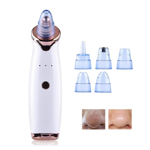 Blackhead Remover Face Deep Pore Cleaner Acne - Horizon Bliss