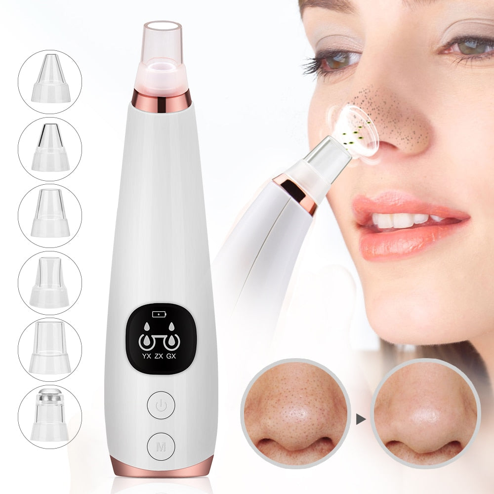 Blackhead Remover Face Deep Pore Cleaner Acne - Horizon Bliss