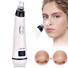 Blackhead Remover Skin Care Face Clean Pore Vacuum - Horizon Bliss