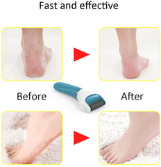 Electric USB Rechargeable Foot Grinder Heel File Grinding Exfoliator - Horizon Bliss