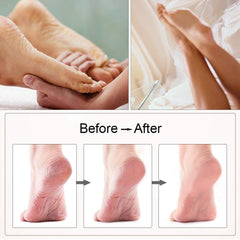 Electric USB Rechargeable Foot Grinder Heel File Grinding Exfoliator - Horizon Bliss