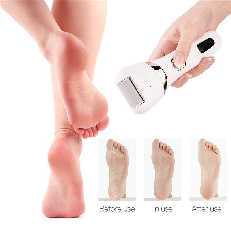 Electric Pedicure Foot Care Tool Files Pedicure Callus Remover - Horizon Bliss